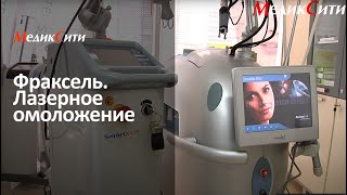 Лазерное омоложение - фракционный фототермолиз в клинике \