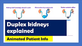 Duplex Kidneys... animated patient info