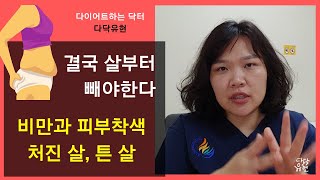 비만인의 피부 착색, 처진살, 튼살. 일단 살부터 빼고 해결방법을 찾아야 한다 [고도비만의사 다닥유현]