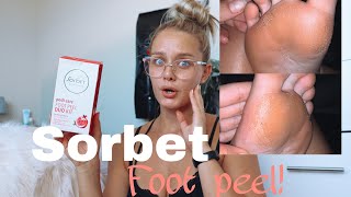 EWW! Trying out the FOOT PEEL from SORBET *loads of dead skin*