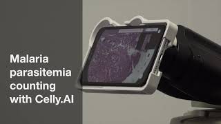 Celly.AI - Malaria Parasitemia Counting (Thin Film, P. falciparum)