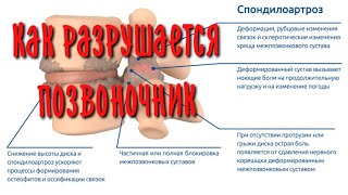 Как разрушается опорно-двигательный аппарат