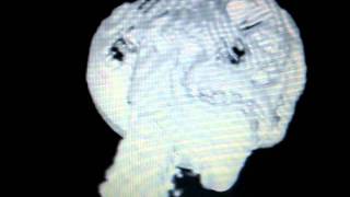 VTK Human Head Visualization 4