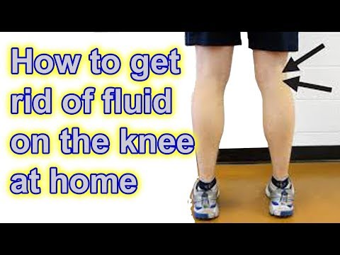 How to get rid of Fluid on The Knee at Home How to get rid of Fluid on The Knee at Home