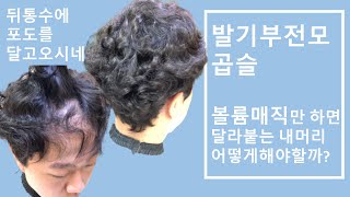 뒷통수 포도밭을 달고온악성곱슬 고객님 (축구장이마에 발기부전모까지 덤)