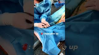 phlebectomy procedure ( #varicoseveinstreatment ) 👨‍⚕️