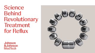 All about LINX Acid Reflux Management System Design | J\u0026J MedTech