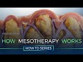 How Mesotherapy Works - How To Series