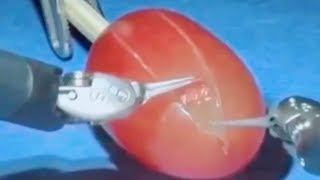 They did surgery on a grape   [MEME REVIEW] 👏 👏#43