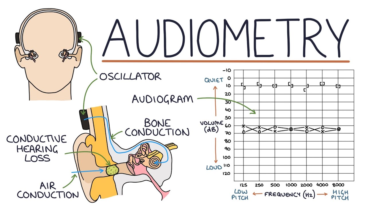Understanding Audiometry And Audiograms Youtube