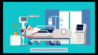 Extracorporeal life support with ECMO - Essential treatment time for doctors and patients