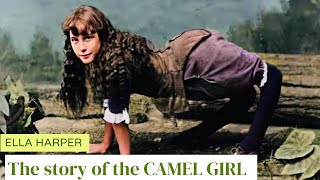 Ella Harper: The Shocking True story of the “CAMEL GIRL”😱😱😳😲