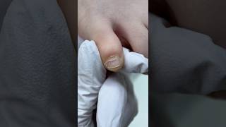 Лайфхак про работе с мизинцами #pedicure #pedicura #ногти