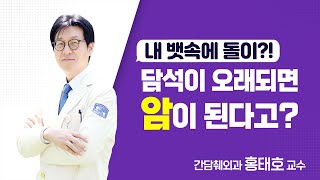 내 뱃속에 돌이?! 담석이 오래되면 암이 된다고? - 간담췌외과 홍태호 교수 | 서울성모병원