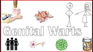 Genital Warts - Causes, Risk Factors, Signs & Symptoms, And Treatment