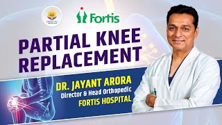Partial Knee Replacement (आंशिक घुटना प्रत्यारोपण) - Exclusive Interview by Dr. Jayant Arora