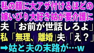 【スカッとする話】私の顔に大アザを付けるほどの嫁いびり大好き姑が要介護に。夫「お前が世話しろよ」私「無理、離婚」夫「え？」➡︎姑と夫の末路が…w【修羅場】【総集編】