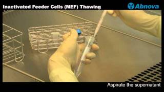 Inactivated Feeder Cells (MEF) Thawing