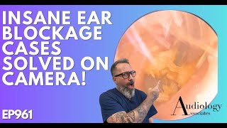 INSANE EAR WAX BLOCKAGES SOLVED ON CAMERA - EP961