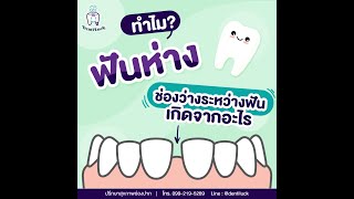 ปัญหาช่องว่างระหว่างฟัน  มีวิธีแก้ไขยังไงได้บ้าง