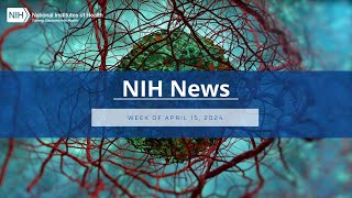 NIH News – Week of April 15, 2024