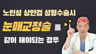 셀라성형외과★ 노인성 상안검 성형수술시 눈매교정을 같이 해야되는 경우! 처진눈꺼풀 수술전 필수 시청영상!