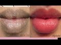 MIRACLE REMEDY TO LIGHTEN DARK LIPS |GET PINK LIP IN 2 DAYS |HOW TO NATURALLY LIGHTEN DARK LIPS MIRACLE REMEDY TO LIGHTEN DARK LIPS |GET PINK LIP IN 2 DAYS |HOW TO NATURALLY LIGHTEN DARK LIPS