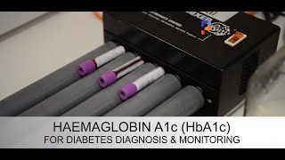 HbA1c - how it can detect glucose in your body for type 2 diabetes