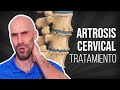 ARTROSIS CERVICAL, ejercicios, masaje y estiramientos para ALIVIAR EL DOLOR