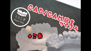 模型からCADCAM冠をつくってみたから見てほしい