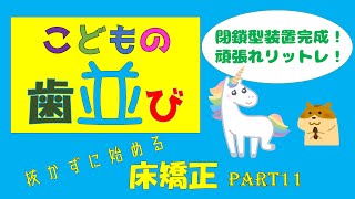 こどもの歯並び　閉鎖型の矯正装置　床矯正PART11