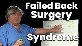 Failed Back Surgery Syndrome (and What to Do About It)