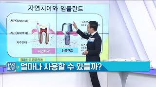 임플란트는 오래 쓸 수 있나요?