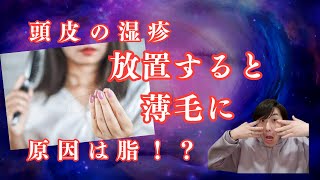 【頭皮湿疹】放置すると薄毛の原因に！なぜなのか徹底解説