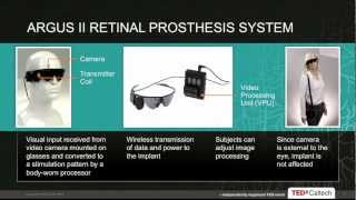 Artificial retina: James Weiland at TEDxCaltech