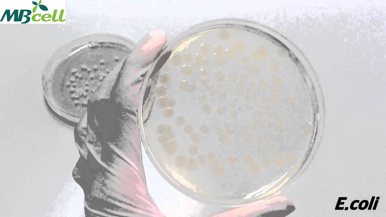 PCA (Plate Count Agar) - YouTube