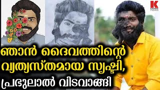 കുറവുകളെ മറക്കൂ,വരൂ ജീവിതം ആസ്വദിക്കാം, പ്രഭുലാൽ ഇനി ഓർമ