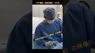 実際の注入映像🎥CRF豊胸で腹腰のいらない脂肪を、お胸に移し替えちゃえます。#モッズクリニック #豊胸 #脂肪注入 #脂肪注入豊胸 #コンデンスリッチ豊胸 #脂肪豊胸 #CRF豊胸 #バストアップ