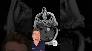 PART 1 - Unilateral hearing loss and tinnitus … what’s the diagnosis? #shorts #medical #health