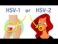 What's The Difference Between Hsv-1 And Hsv-2 (explained In 2 Minutes)