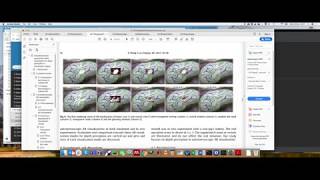MPHY0026: Visual Perception Example