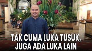 Tak Cuma Luka Tusuk, Aktor Sandy Permana juga Derita Luka akibat Benda Tumpul