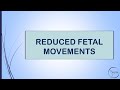 RCOG GUIDELINE REDUCED FETAL MOVEMENTS