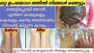 how to pedicure manicure at home Malayalam | ഒറ്റ ഉപയോഗത്തിൽ നിങ്ങൾ ഞെട്ടും |Pedicure at Home