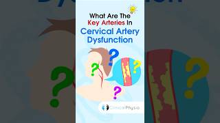 Cervical Artery Dysfunction #physicaltherapy #physiotheraphy #anatomy