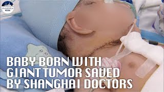 Shanghai doctors successfully operate on newborn with congenital heart disease and giant tumor