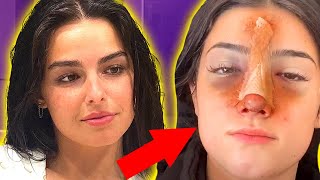 THIS is why Tik Tok star Charli D'Amelio had SURGERY & Addison Rae SECRET podcast revealed!