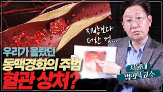 혈관을 막히게 하는 주범, 혈관 상처! 왜? 무엇 때문에 생길까? 막을 방법은?