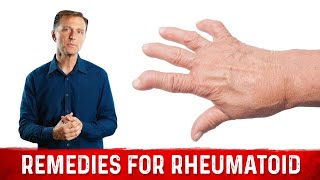 Best Remedies for Rheumatoid