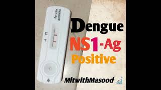 Dengue NS1 Ag test positive // dengue NS1 test positive // dengue Ag positive / #dengue #testing